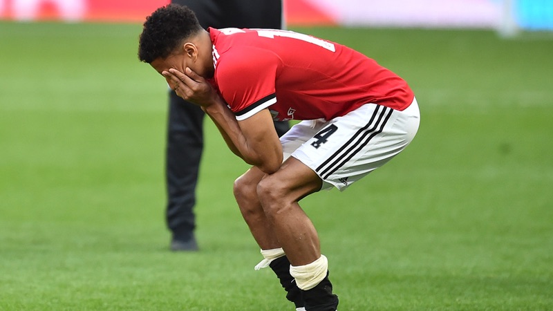 Cầu thủ Jesse Lingard - Nạn nhân của bệnh ngôi sao